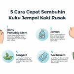 Terbukti! 5 Cara Cepat Sembuhin Kuku Jempol Kaki Rusak